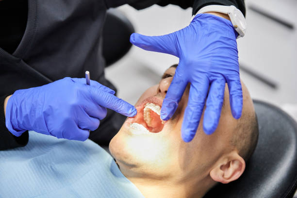 Best Emergency Root Canal Treatment in Mangonia Park, FL